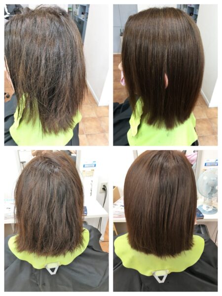 フォルムコントロール