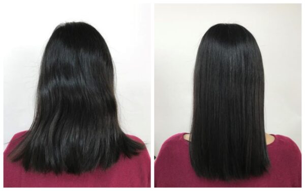 酸熱トリートメント