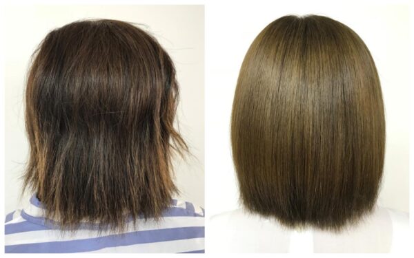 酸熱トリートメント