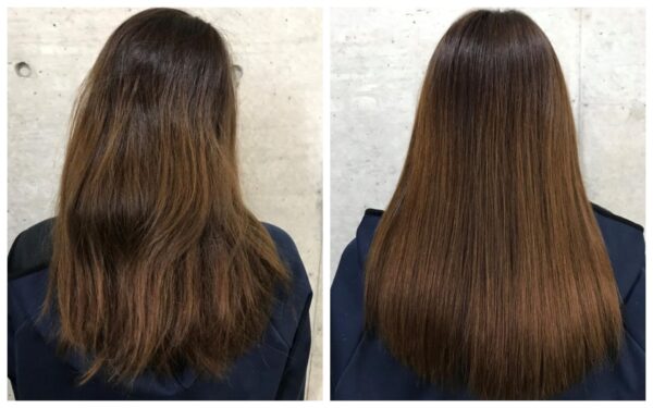 酸熱トリートメント