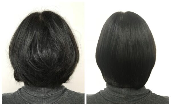 酸熱トリートメント