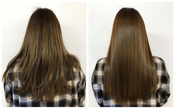 酸熱トリートメント