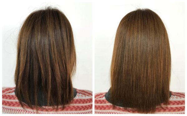 酸熱トリートメント